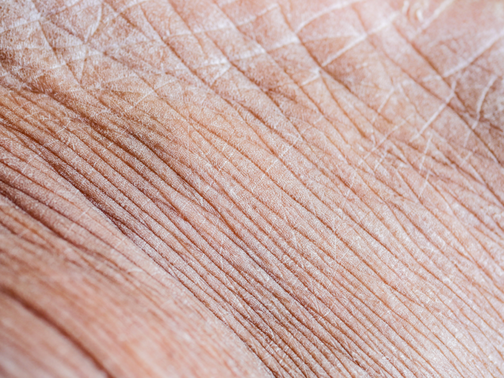 Helpt collageen tegen rimpels - collageen.nl